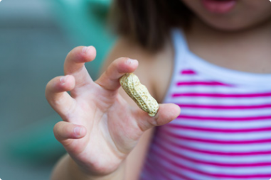 We eat a variety of food items in the day and to surmise and judge the allergen responsible for causing the allergy might be difficult. Food items like peanuts, milk, eggs and wheat are most likely to cause food allergies and you’d find many people around you complaining of the same. Although allergies might prevent us from eating certain food items, sometimes even the ones that we crave for the most but there are substitutes and alternatives that could always help with such issues. Exploring food allergies: An overview Food allergies are a result of the immune system reacting to certain proteins in the food item by identifying them as a threat to the body. One is liable to develop a food allergy at any age but these are mostly stimulated during childhood. If your parents have any food allergies, you might inherit the same but to predict the odds is difficult. You might not always outgrow the allergies, they could be short lived or be triggered life long. The reactions of a food allergy could be from mild to severe and even prove to be life-threatening. It is best to be aware of the symptoms early for the food allergies to not worsen their reactions later. Closely used with allergies is another term called intolerances, people might end up being confused between the two. While allergies can trigger serious reactions, food intolerances are less severe and one can actually eat small amounts of the food item without it harming them, contrary to allergies where one has to abstain from eating it at all. There are mainly two types of allergic reactions - IgE-Mediated - These are immediate reactions that occur within minutes to hours of consuming the allergen. They usually trigger the release of histamine which might result in mild to severe symptoms, including anaphylaxis. Non IgE-Mediated - These are delayed reactions that occur within hours to days of consuming the allergen. Other parts of the immune system react to these allergens and cause gastrointestinal or skin related symptoms. List of top 20 most common food allergies Food allergies can be caused by a variety of food items, most of these are items we consume in our daily meals. Refer to this list of common food allergies which might help you identify yours- Milk Eggs Sesame Soy Peanuts Tree nuts like walnuts, almonds and cashews Shellfish like shrimp Wheat Fish Celery Triticale Mustard Barley Garlic Coriander Corn Onions Meats like chicken, beef and pork Mushrooms Avocado Identifying and managing symptoms of food allergies Common food allergies might trigger mild or alarming symptoms, they differ from person to person and are indicators to their specific food allergies. Common symptoms of food allergies include - Itchy and red skin Hives Itching or tingling in mouth Swelling of lips, tongue, throat and face Diarrhoea, vomiting, abdominal pain Wheezing and trouble breathing Lightheadedness, dizziness and loss of consciousness Runny nose Watery eyes Anaphylaxis is a severe and sudden reaction to an allergen, mostly occurring immediately after the consumption. Such reactions can sometimes be life-threatening and one must get medical attention as soon as the first symptoms are recognised. Rarely do these symptoms get delayed by hours. Symptoms of anaphylaxis include - Unresponsiveness and loss of consciousness Instant swelling of lips, mouth, tongue and throat Itchy skin and sudden rashes Shortness of breath, wheezing or breathing rapidly Lowering of blood pressure Difficulty swallowing Tongue, lips, skin turn blue or pale Hoarse voice Children becoming limp or floppy Streaming eyes and runny nose Once you do recognise any of these common symptoms of food allergies, your health care professional is likely to conduct a few methods and tests to identify your food allergy - Skin prick test Blood test Oral food challenges Elimination diet Patch tests At the beginning of your diagnosis, your doctor would ask for a detailed list of symptoms, would look into your family’s history of allergies and do a physical examination of your health problems as well. You might be asked to maintain a food diary which would state the food items you eat in a day and the symptoms they cause. Once you’ve identified your food allergy, there are a few ways to manage it - Avoiding the consumption of the allergen completely. Read food labels carefully and attempt to understand the specifications. Most healthcare professionals also prescribe medications to treat food allergies, especially in severe cases. When you’re eating outside, the chef must be well aware that you’re allergic to a specific ingredient and must avoid putting it in the meal at all cost. The food item that you’re allergic to might be an important source of nutrition. There are substitutes for everything in the market today, be sure to look out for yours. Oral immunotherapy is being used today to treat common food allergies where increasing amounts of allergen is given to the person to desensitise the immune system’s reaction towards it. If you have a severe case of allergy, cooking utensils and surfaces must be cleaned thoroughly and free from the allergen as well. Conclusion Food allergies commonly caused by milk, eggs, peanuts and soy might have troublesome reactions on the body but can be managed carefully by employing the right solutions. One might or might not be able to outgrow their food allergy but to have it under control such that the effects are negligible is the path to choose. To get diagnosed at the right moment helps in effectively dealing with the common symptoms of food allergies. Frequently Asked Questions What are the most common food allergies? Common food allergies are caused by allergens like milk, eggs, sesame, soy, peanuts, tree nuts, shellfish, wheat and fish. What are the typical symptoms of food allergies? Typical symptoms of food allergies include itchy and red skin, hives, itching or tingling in mouth, swelling of lips, tongue, throat and face, diarrhoea, vomiting, trouble breathing, dizziness, loss of consciousness, runny nose and watery eyes. Are there any effective treatments for food allergies? There is no cure that can fully heal a food allergy but it can be managed by avoiding the consumption of the allergen, reading food labels thoroughly, oral immunotherapy, being careful while eating outside and taking the prescribed medicines. How can one manage and cope with food allergies effectively? Managing and coping with food allergies includes employing ways like finding substitutes of the allergen, reading food labels, being careful while eating outside, avoiding the consumption of the allergen and thoroughly rinsing any common cooking utensils and surfaces. How can one determine if they have a food allergy? You might be able to sense certain symptoms after eating a particular food item which could be the initial indication of a possible food allergy. However, food allergies are diagnosed by skin prick test, blood test, oral food challenges, elimination diet and patch tests. How prevalent are food allergies in the general population? Globally, food allergies affect 1-10% of the population while the prevalence is regulated by a variety of factors.