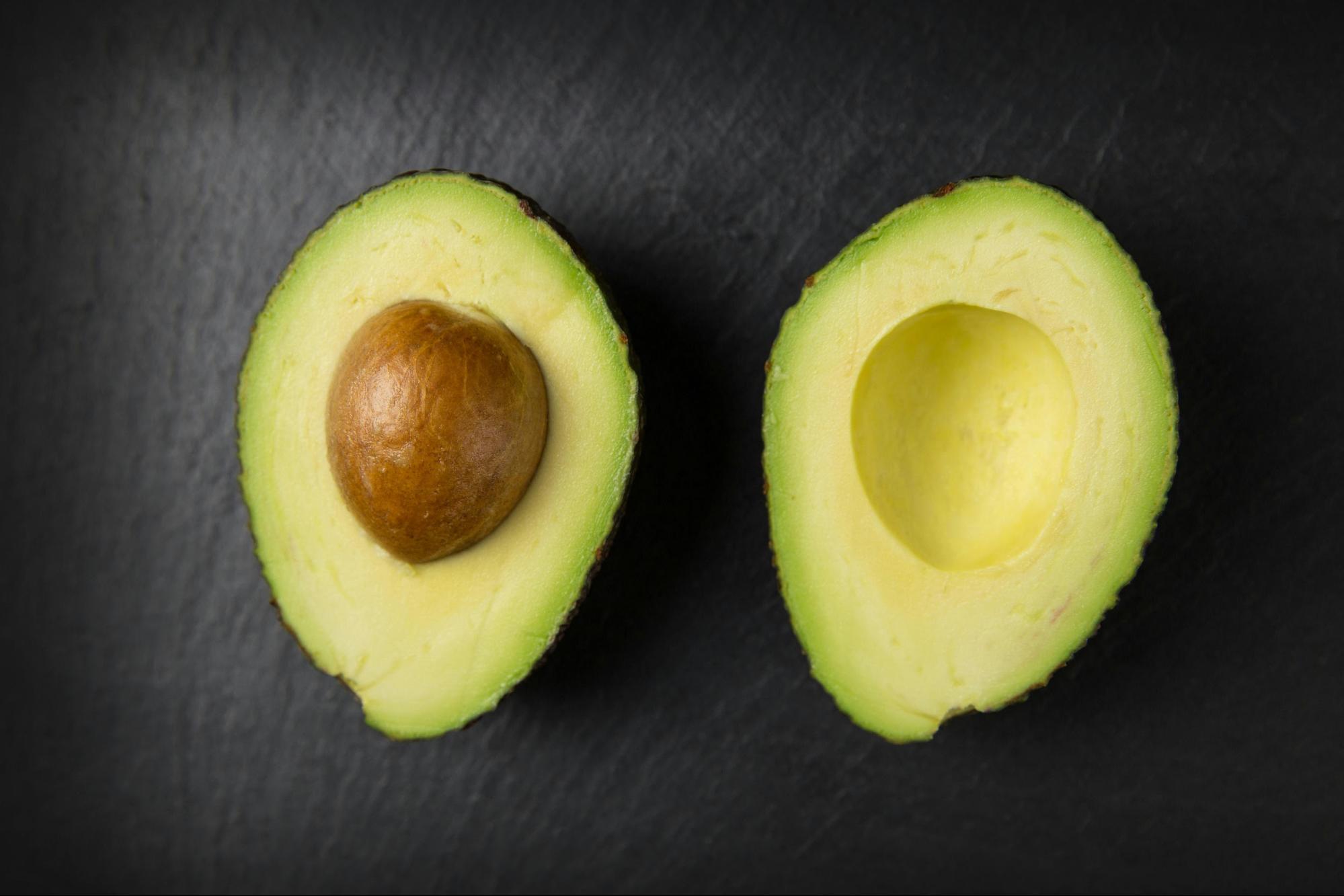 know and learn about foods that reduces anxiety