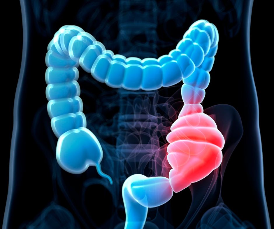 learn and know about constipation 